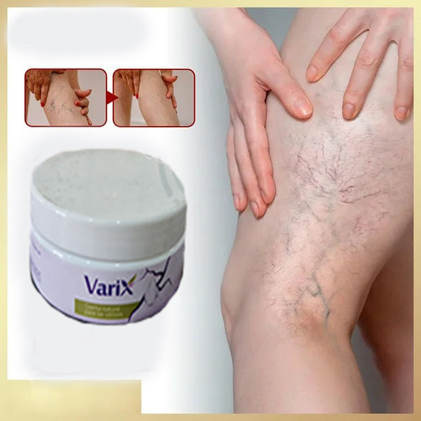 CREMA PARA VARICES (Alivio que transforma tu día.)